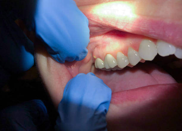 Best Mobile Emergency Dentist in Jefferson, NC
