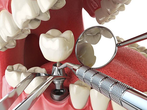 Best Weekend Emergency Dentist in Jefferson, NC