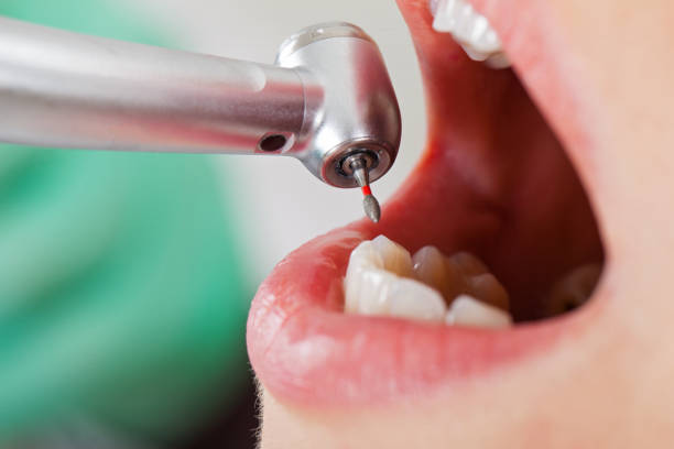 Best Pediatric Emergency Dentist in Jefferson, NC